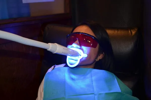 29940 da vinci laser teeth whitening procedure