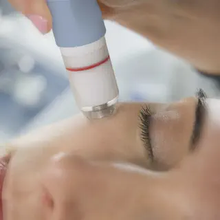 /img/29947-microdermabrasion-skin-whitening-7.webp