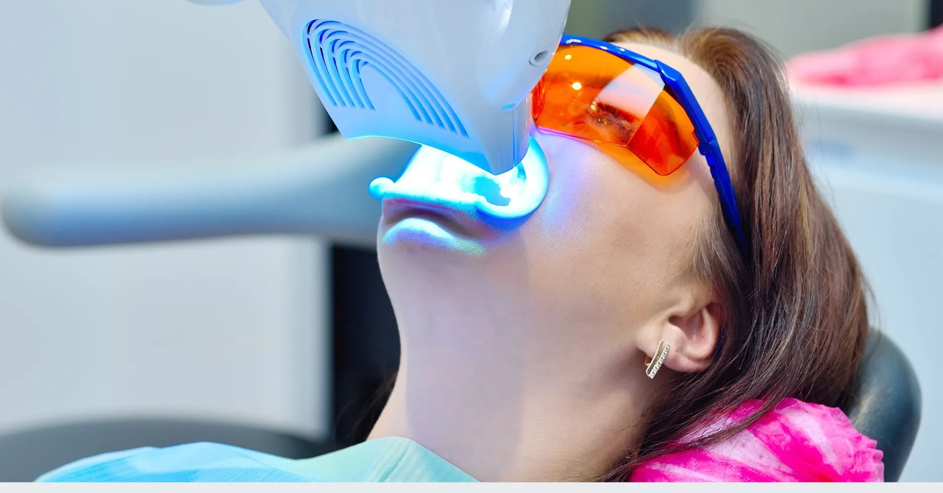 29951 at home whitening