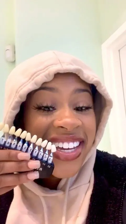 29952 mint teeth whitening application