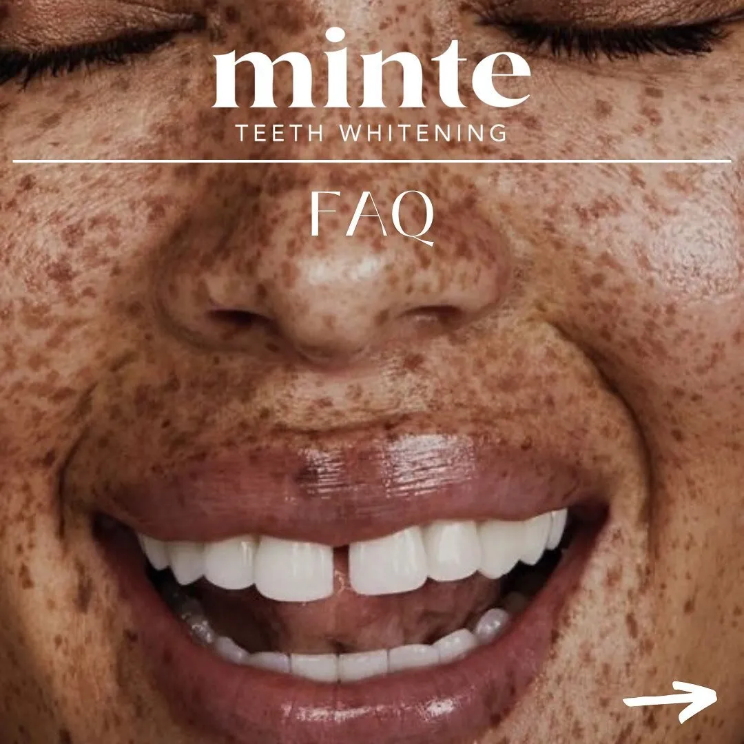 /img/29952-mint-teeth-whitening-confident-smile.webp