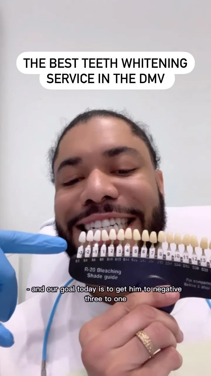 29952 mint teeth whitening maintenance