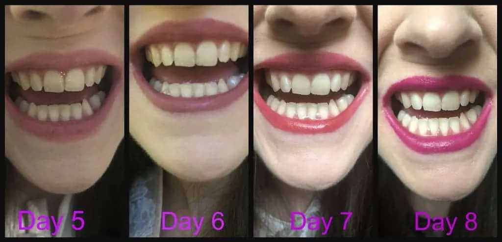 29971 snow teeth whitening cost