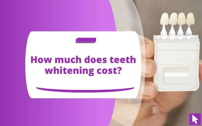 29977 professional teeth whitening