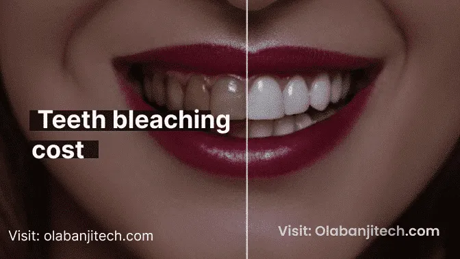 29977 teeth whitening cost overview