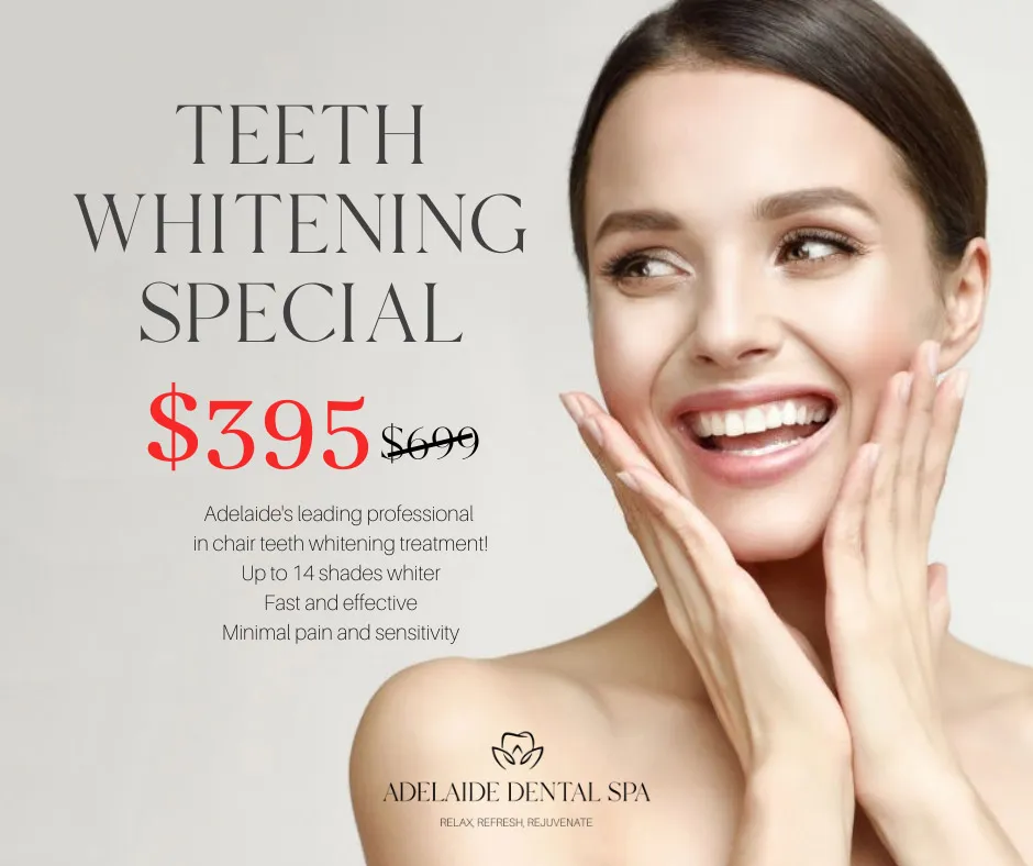 29982 professional teeth whitening