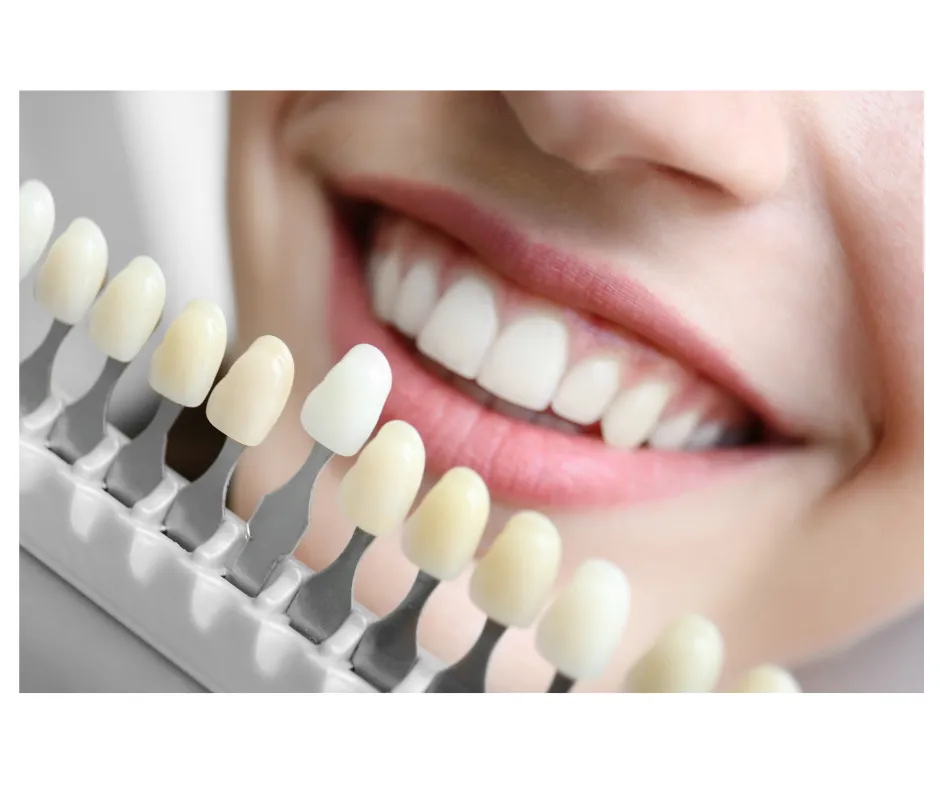 29982 whitening toothpaste
