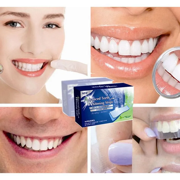 29983 alternative whitening braces