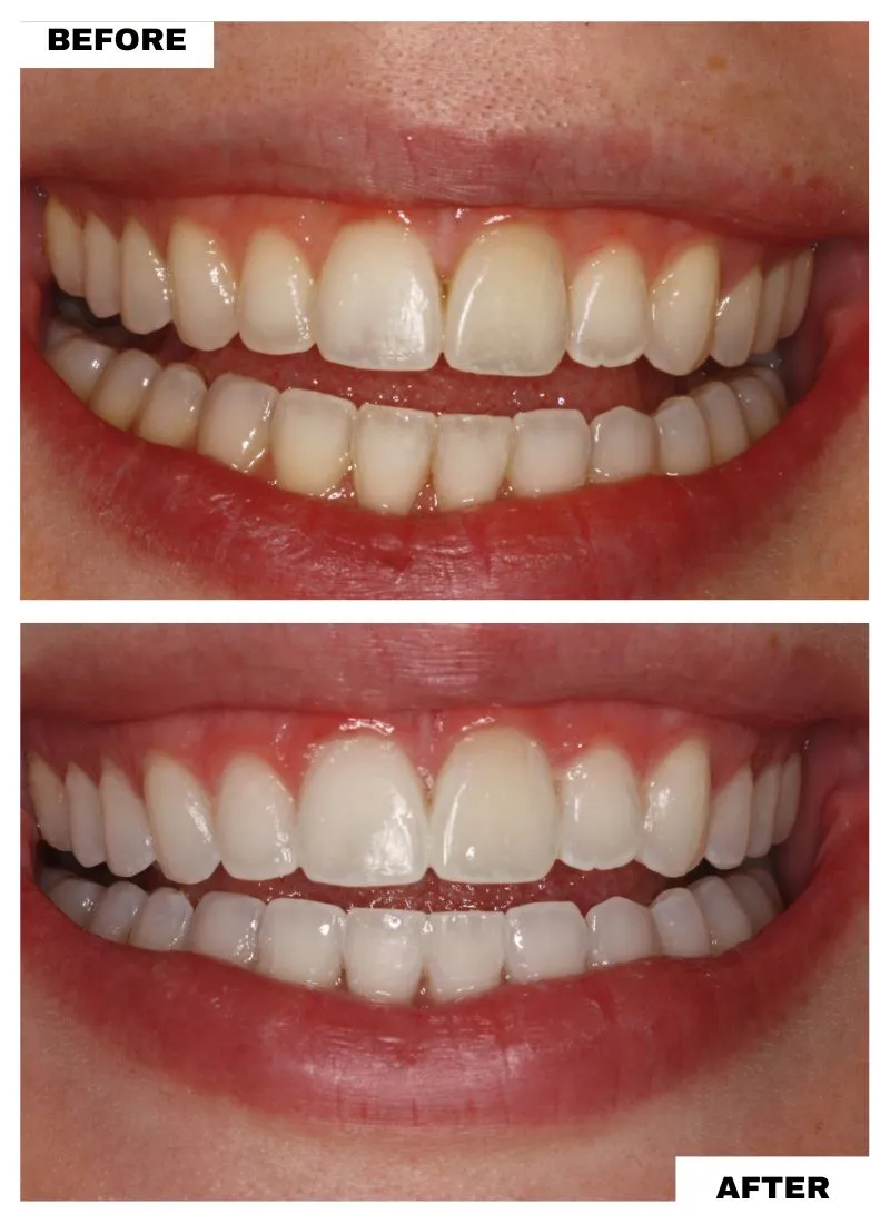 29992 whitening toothpaste