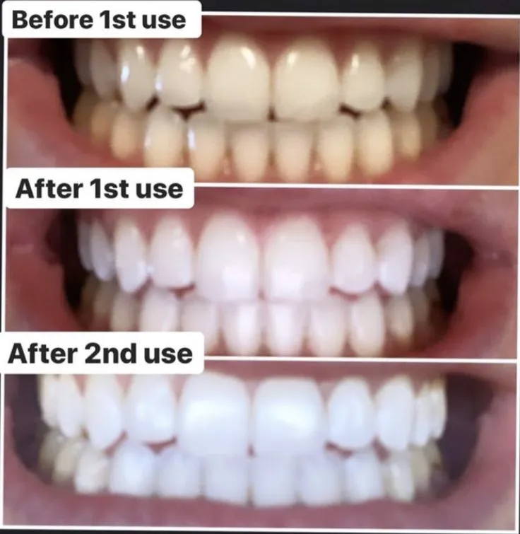 29996 oral hygiene tips