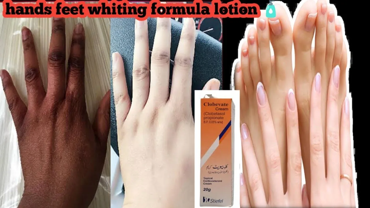 30000 moisturizing hands