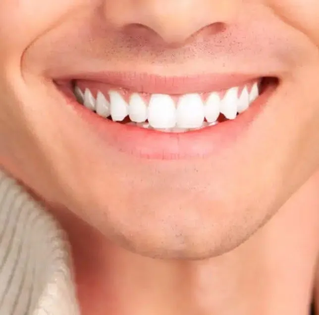 30004 discolored fillings